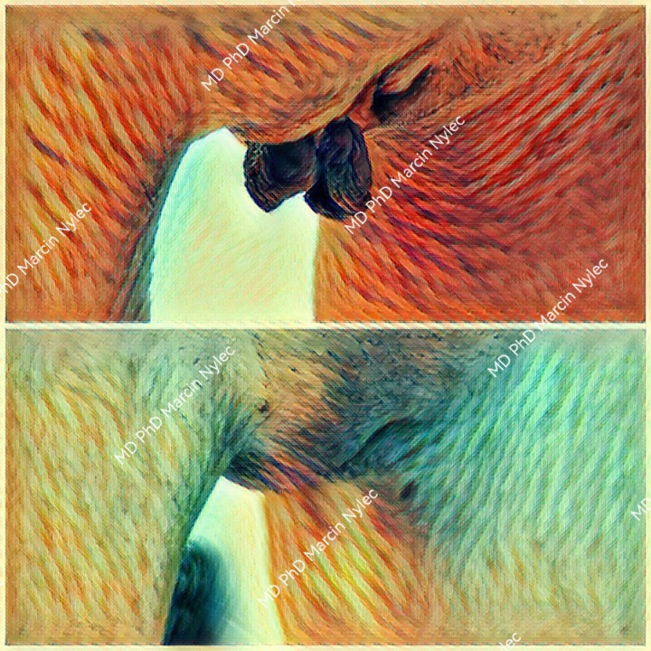 labioplastyka rzeszów pacjentka 10